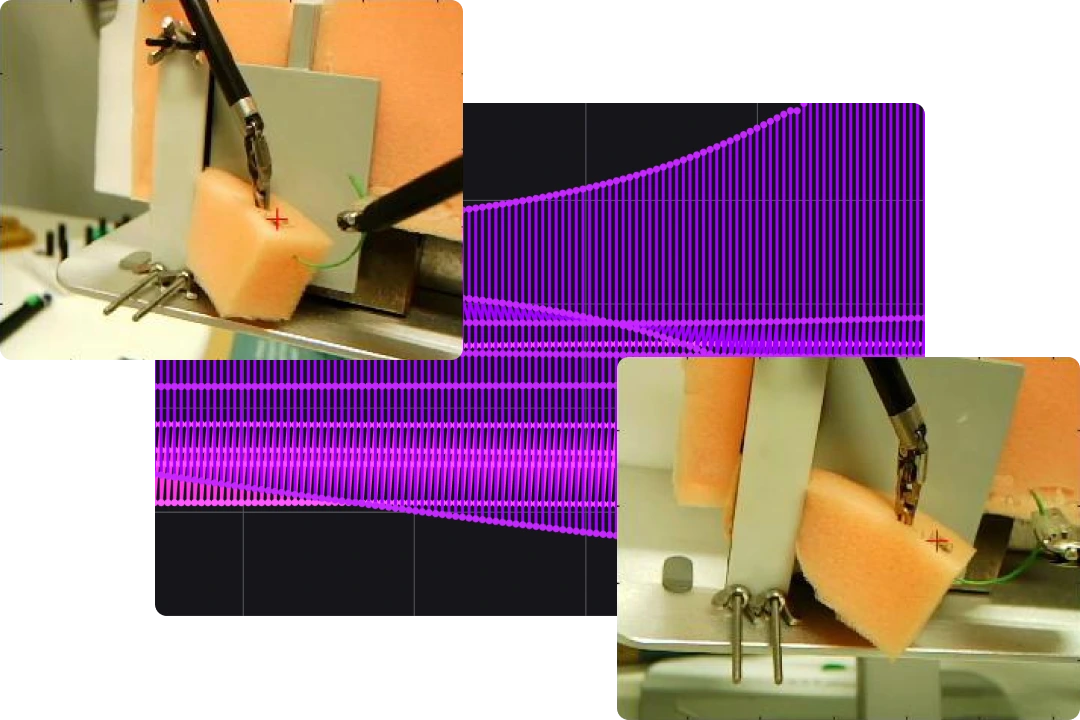 Connecting to health robotics data in Foxglove